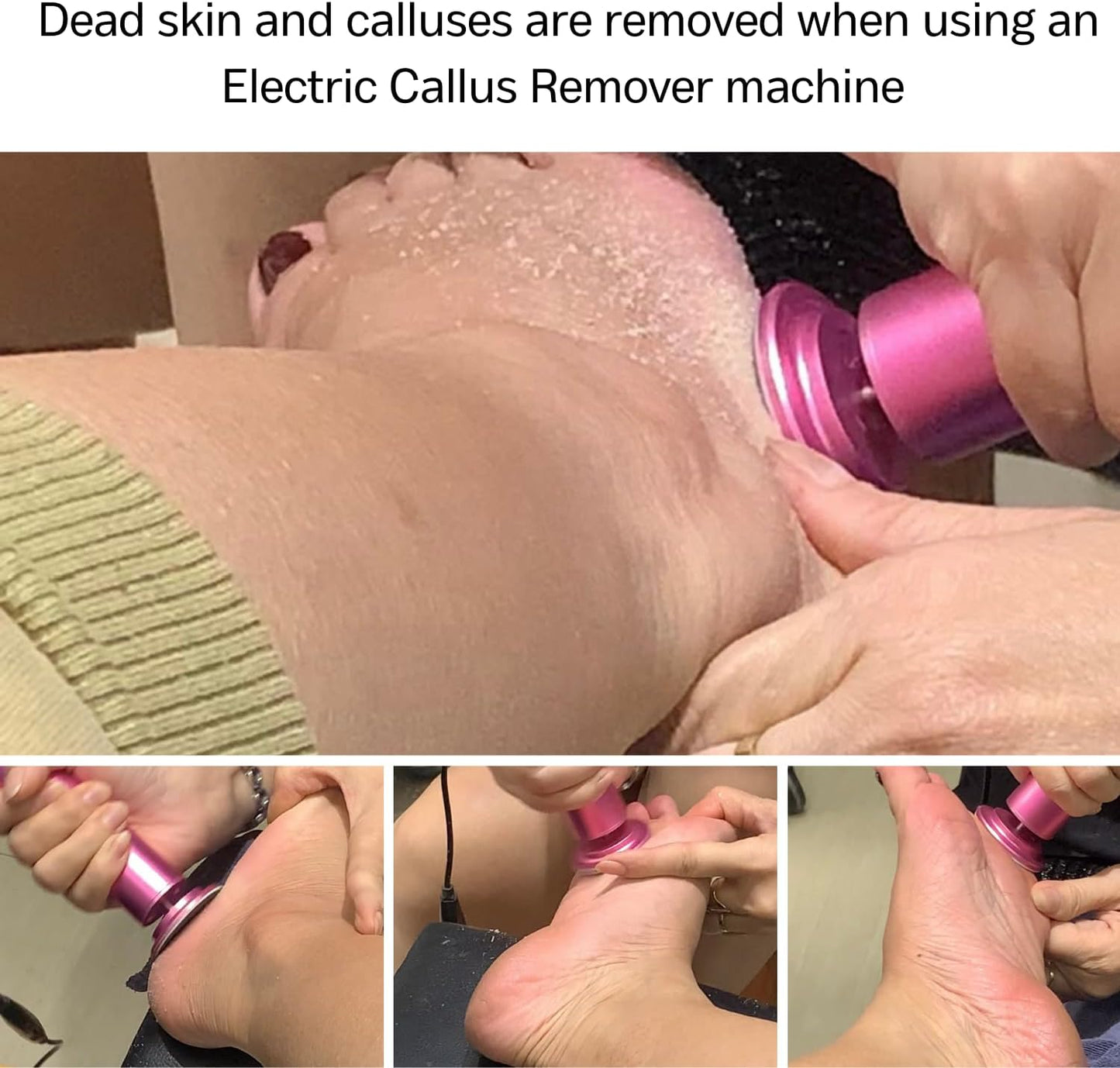 đź’Ą Free Shippingđź’Ą 48% Off-Electric Foot callus Remover